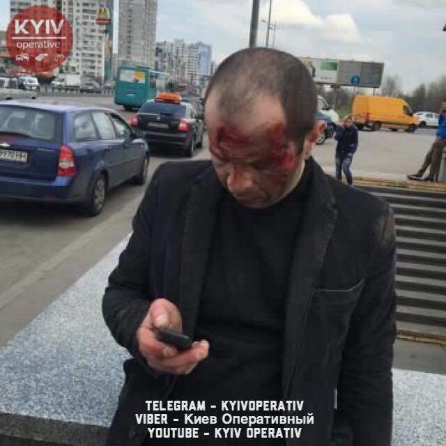 В Киеве "ВАЗ" сбил пьяного пешехода (Видео, фото) 