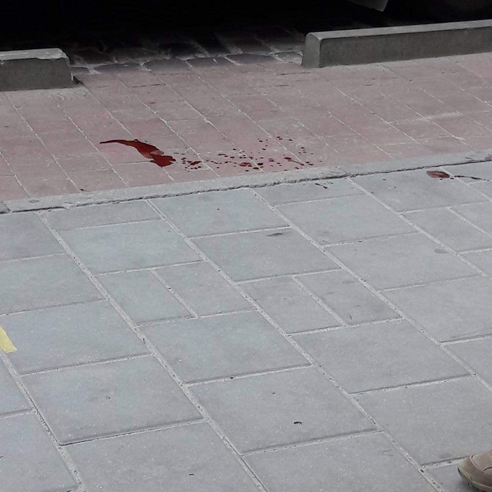 Во Львове мужчина с разбитой головой упал посреди улицы (фото)