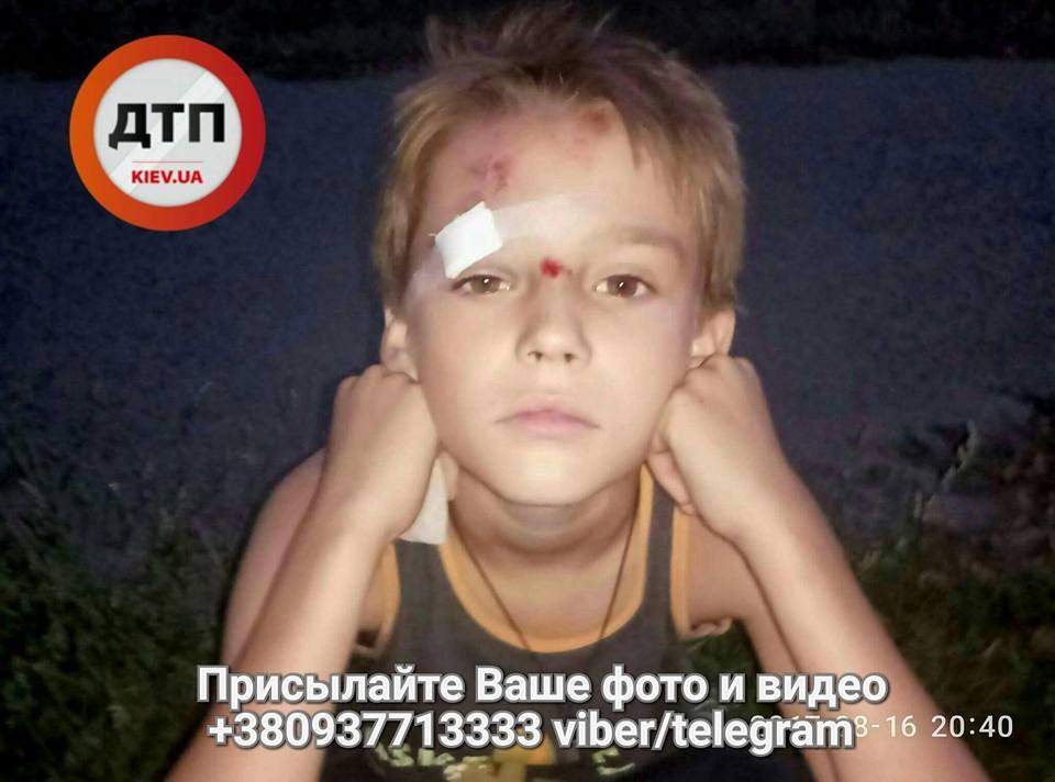В Киеве произошло вело ДТП, пострадал ребенок (Фото)