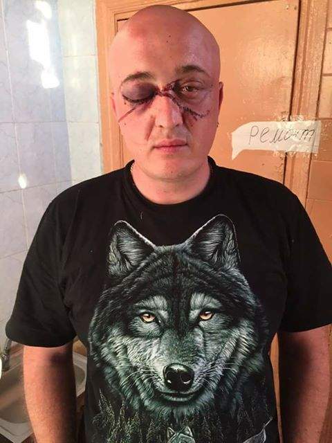В ночном клубе Одессы посетителя побили охранники (Фото)