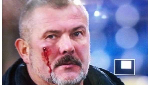 Во время футбольного матча фанаты "Днепра" избили нардепа Березу (Фото)