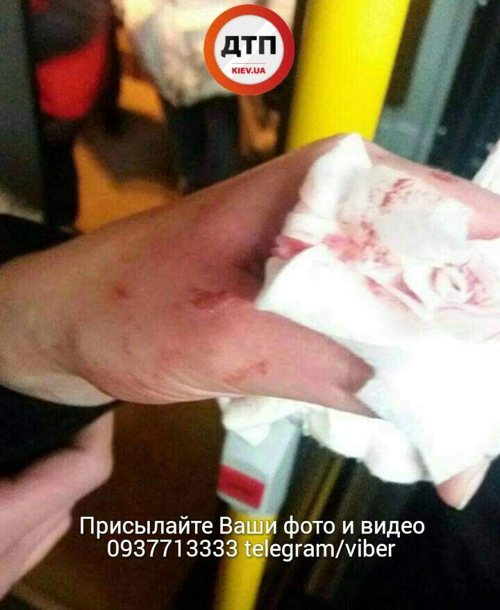 В Киеве неизвестные закидали камнями автобус с людьми (фото)