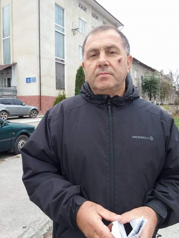 В Тернопольской области депутат от «БПП» избил местного предпринимателя (фото)