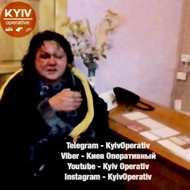 В Киеве мужчина изнасиловал женщину и выбил ей глаз (Фото)