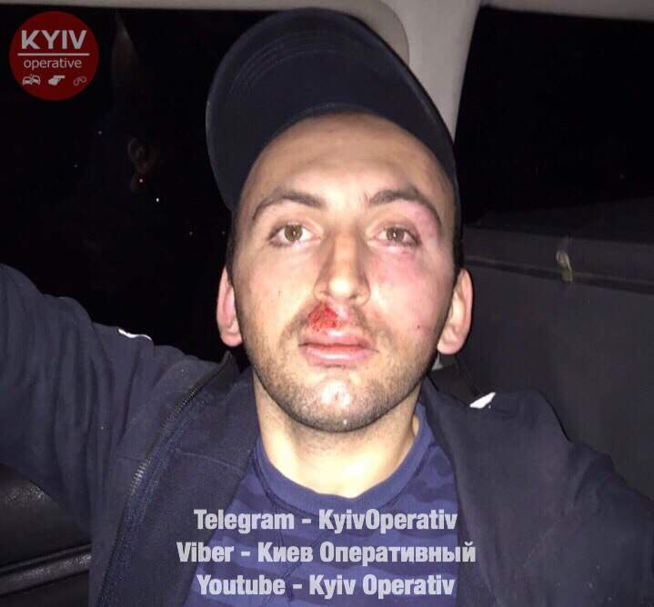 В Киеве группа иностранцев ограбила женщину (фото)