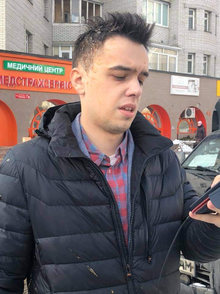 В Киеве неизвестные забросали яйцами волонтера сайта 