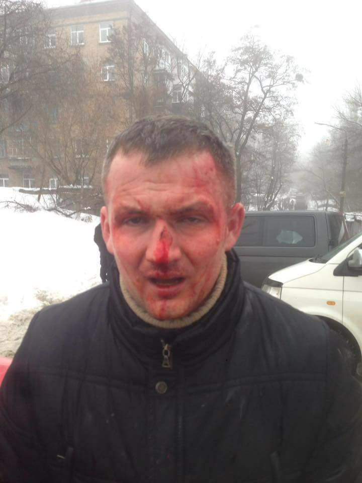 В Киеве неизвестные побили депутата и забрызгали глаза из баллончика (Фото) 