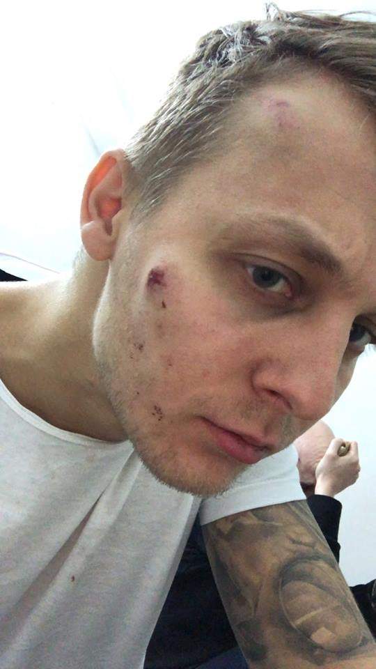 В Киеве серьезно избили старшего сына депутата Нестора Шуфрича (фото)