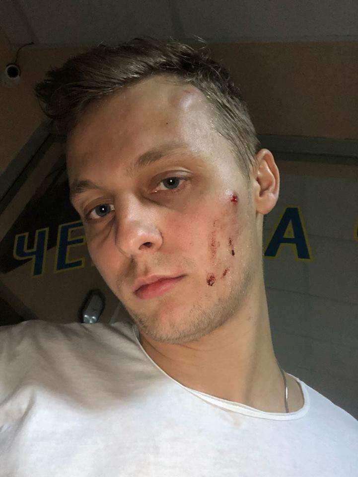 В Киеве серьезно избили старшего сына депутата Нестора Шуфрича (фото)