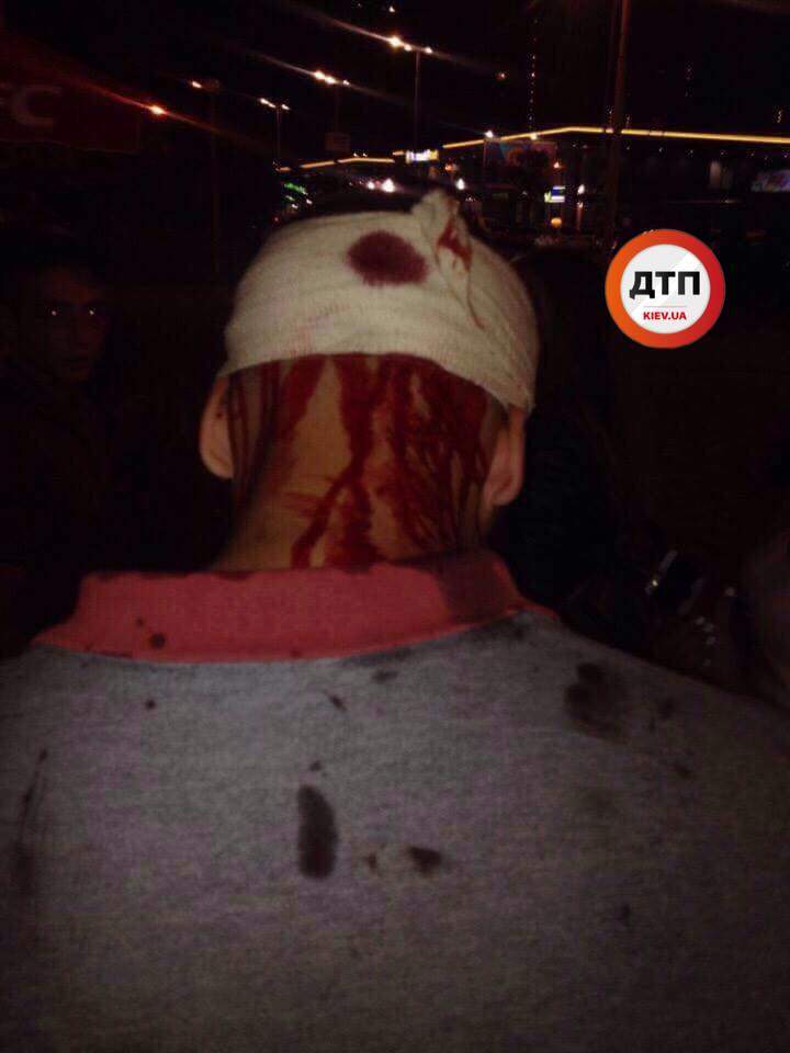 В Киеве ромы бутылкой разбили голову подростку, а после пытались его добить