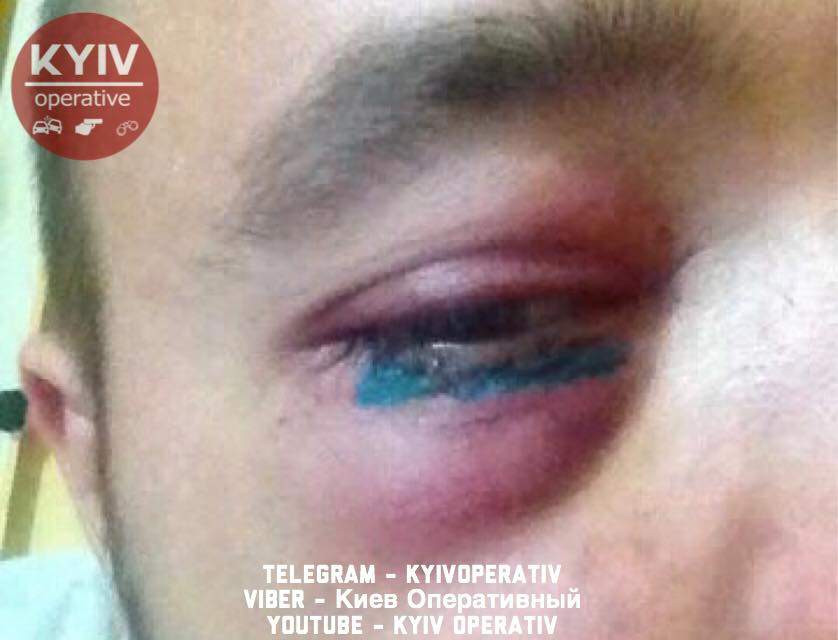 В Киеве разыскивают двоих злоумышленников, которые ограбили и избили мужчину (фото)