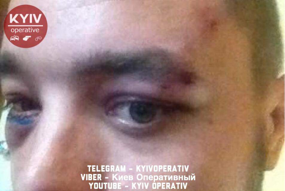 В Киеве разыскивают двоих злоумышленников, которые ограбили и избили мужчину (фото)