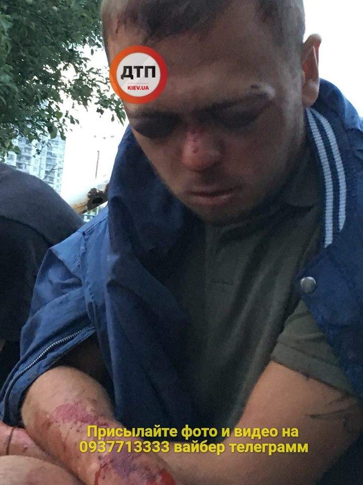В Киеве неизвестные жестоко избили мужчину (фото)