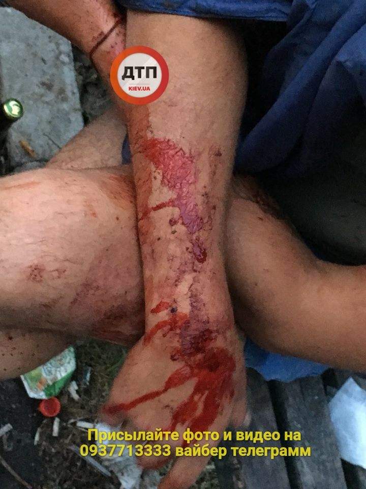 В Киеве неизвестные жестоко избили мужчину (фото)