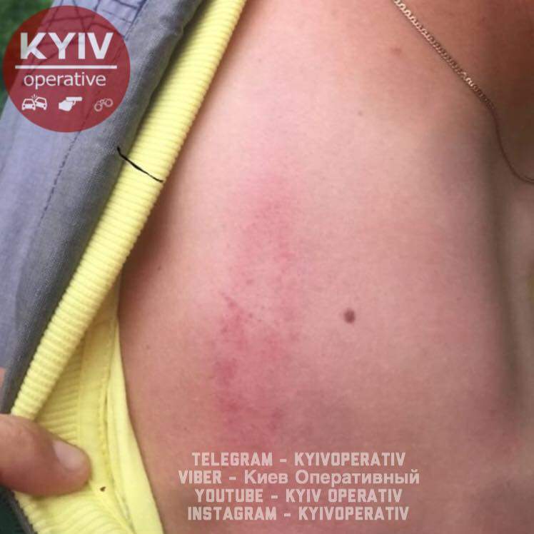 В Киеве ромы напали на местного жителя (фото)
