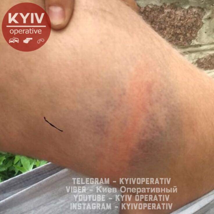 В Киеве ромы напали на местного жителя (фото)