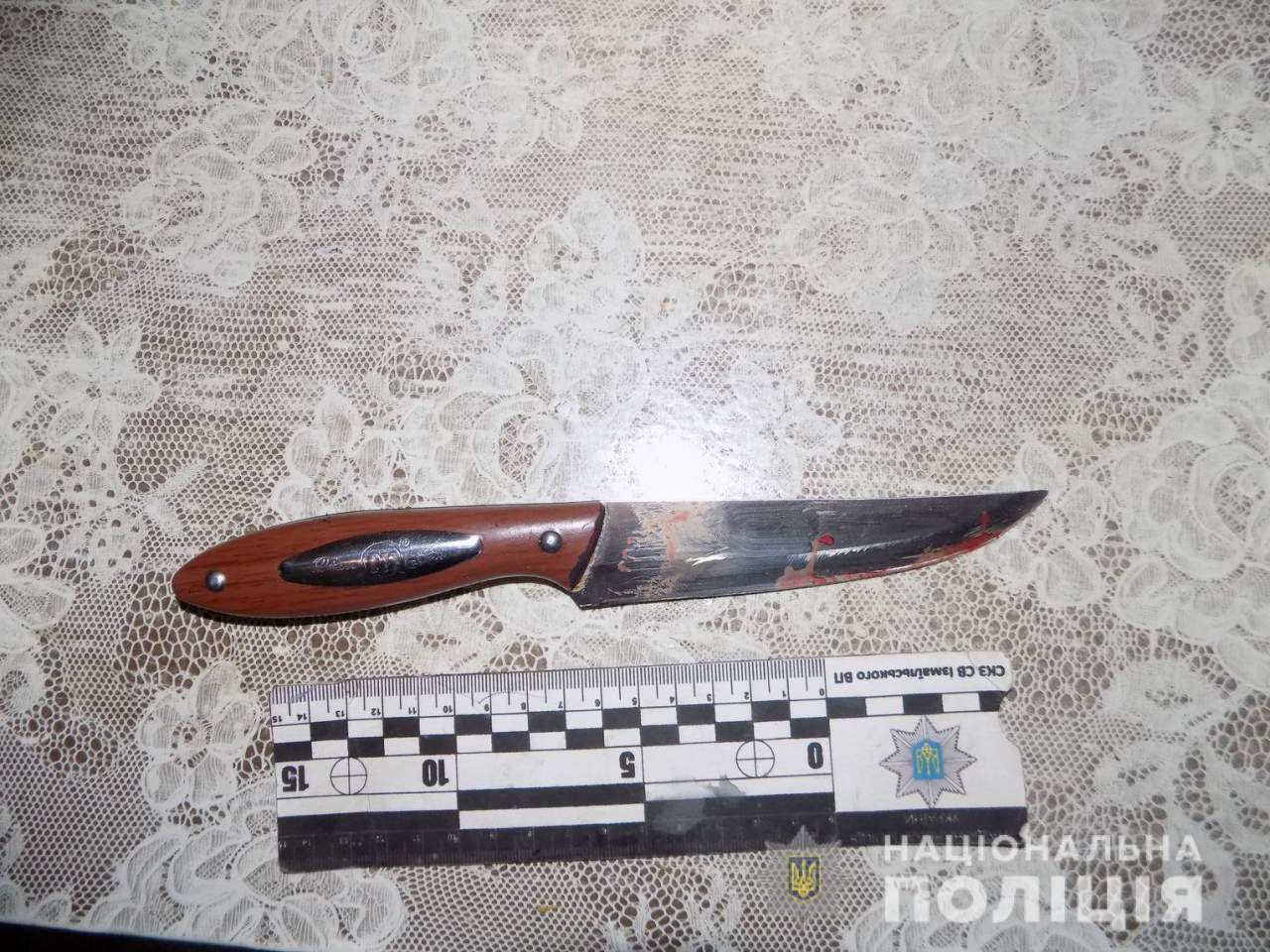 В Одесской области мужчина устроил резню на территории больницы. Есть жертвы