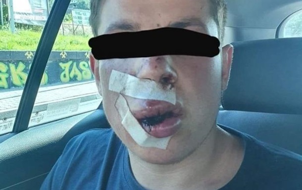 На юге Польши жестоко избила студента из Украины